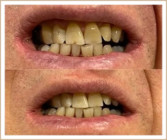 Before & After Treatment Result Happy Client 3