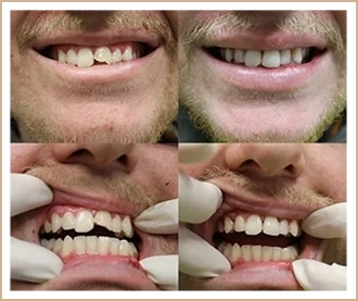 Before & After Treatment Result Happy Client 1