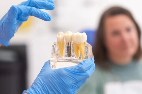 what can i eat after dental implant surgery check