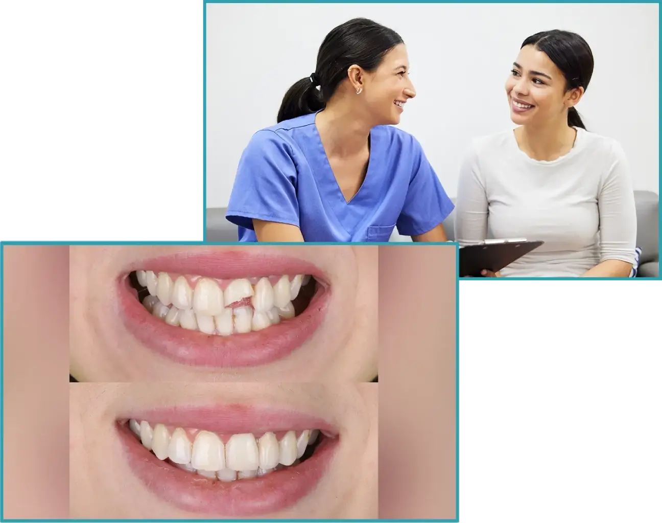 Crowns and Bridges at Our Clinic