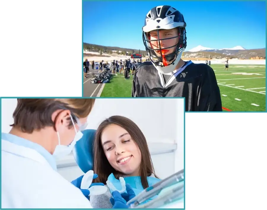 Sports Mouthguard at Our Clinic
