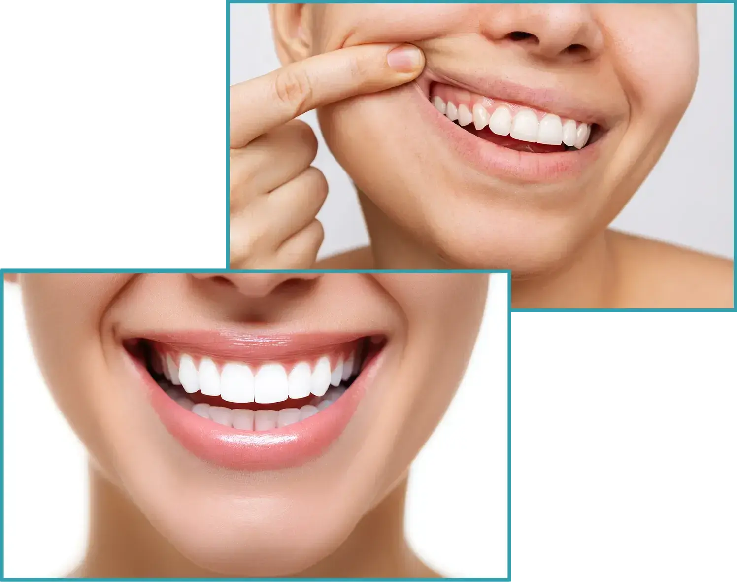 Why Choose Gum Disease Treatment at boutique dental and cosmetic campbelltown
