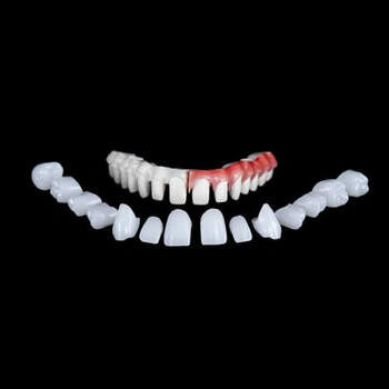 what happens to teeth under veneers set